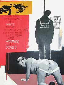 Wounds and scars